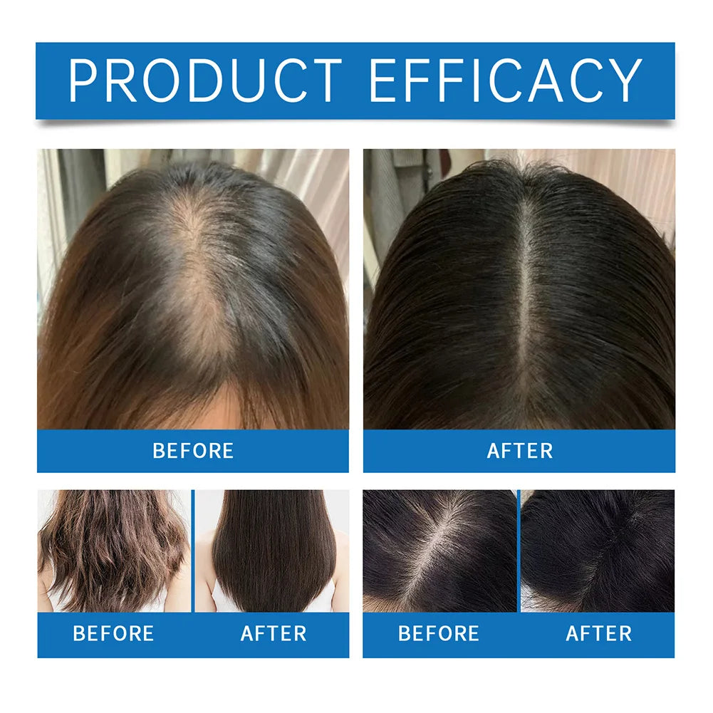 Hair Care Essential Oil Nourishing Soothing Scalp Serum For Hair Loss Fast Grow Strengthening Hair Massage Serum Hair Care
